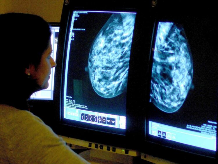 photo shows someone looking at breast scans on a computer screen.