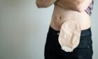 Heenan stole the colostomy bag. Image: Shutterstock.