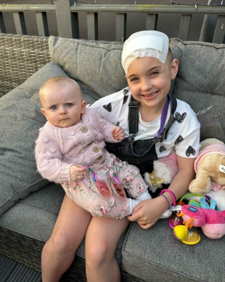 Myla with her baby cousin Maya just days after her surgery