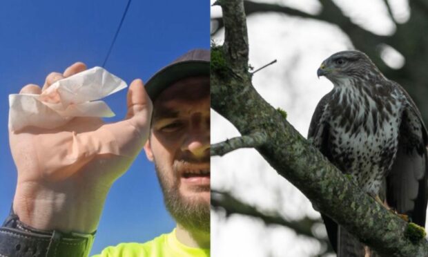 Joe Bishop shows off a hand injury after being attacked in Angus by a buzzard.