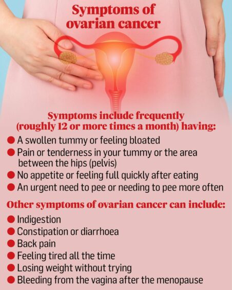 A poster showing early warning signs of ovarian cancer.