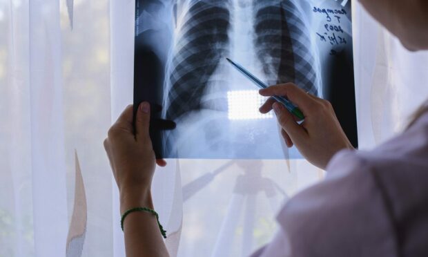 NHS radiology outsourcing; doctor looks at X-ray