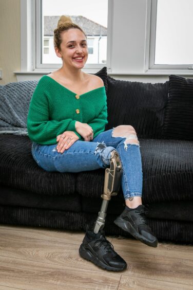 Chantelle pictured with her prosthetic leg.