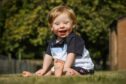 Little Gregor Chisholm has Down's syndrome and is now recovering after open heart surgery.