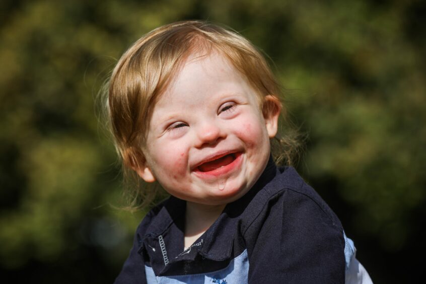 Little Gregor was born with Down's syndrome.