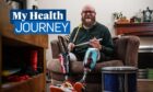 Dundee man Scott Campbell plans to get back to drumming after having both legs amputated.