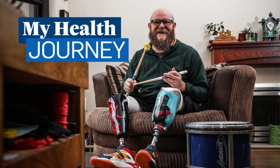 Dundee man Scott Campbell plans to get back to drumming after having both legs amputated.