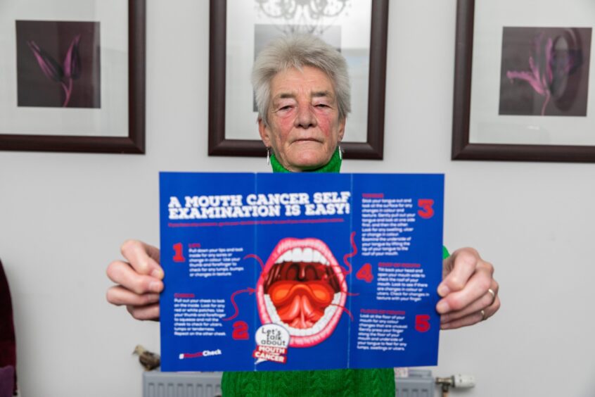 Barbara Boyd (65) at home in Kirkcaldy where she is hoping to raise awareness surrounding Mouth Cancer, from which she is a survivor, using the slogan 'Mind Your Mooth'. 