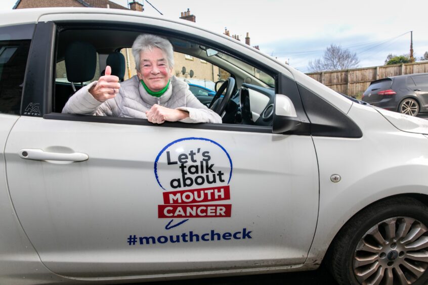 Barbara has been working with charity 'Let's Talk about Mouth Cancer'. 