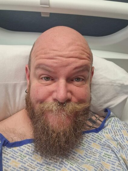Scott, who has type 2 diabetes, pictured in Ninewells Hospital, Dundee the day after his second amputation.