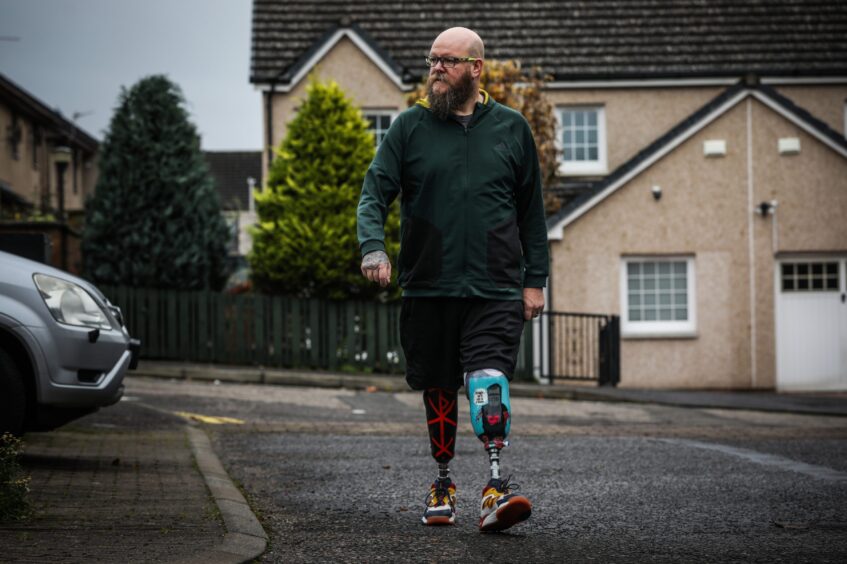 Scott Campbell from Dundee has type 2 diabetes and developed infections in both feet