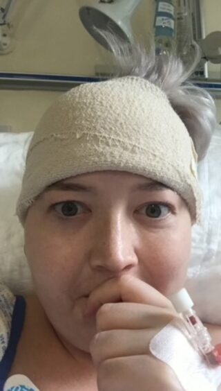 Cancer survivor Rachel Coats pictured after her brain surgery