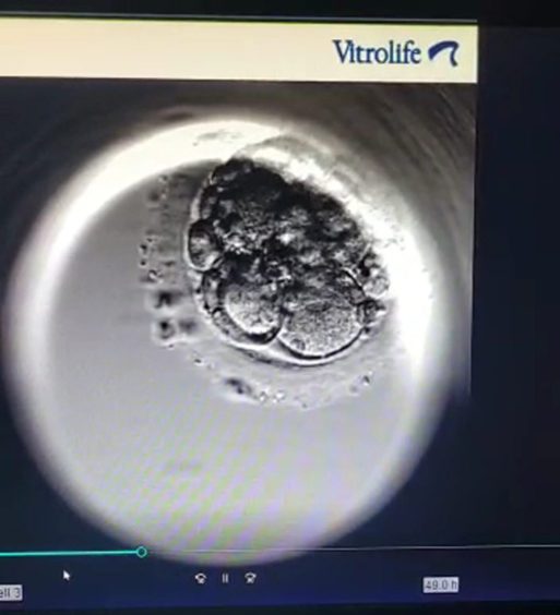 Image on screen of embryo