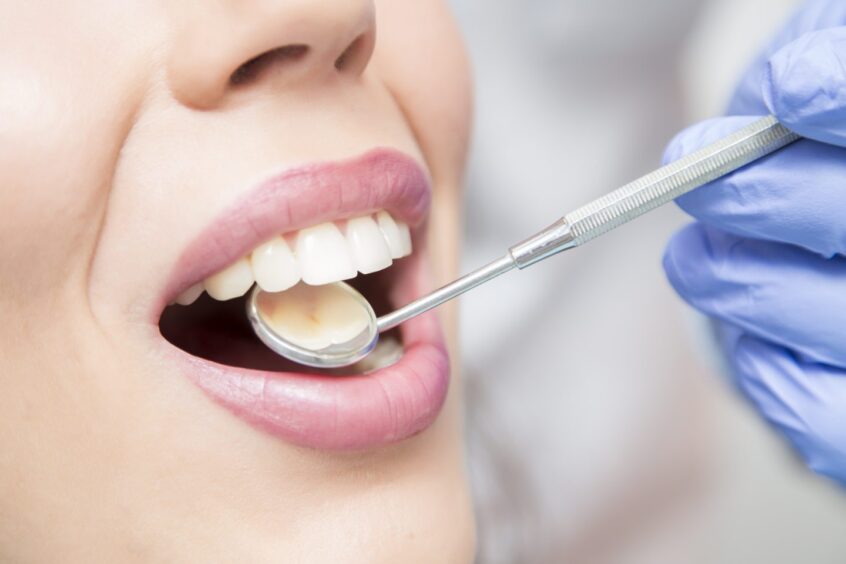 close-up of a person's mouth as a dentist uses a tool to inspect teeth 