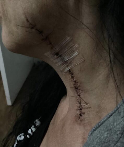Jeanette Irvine slashed neck