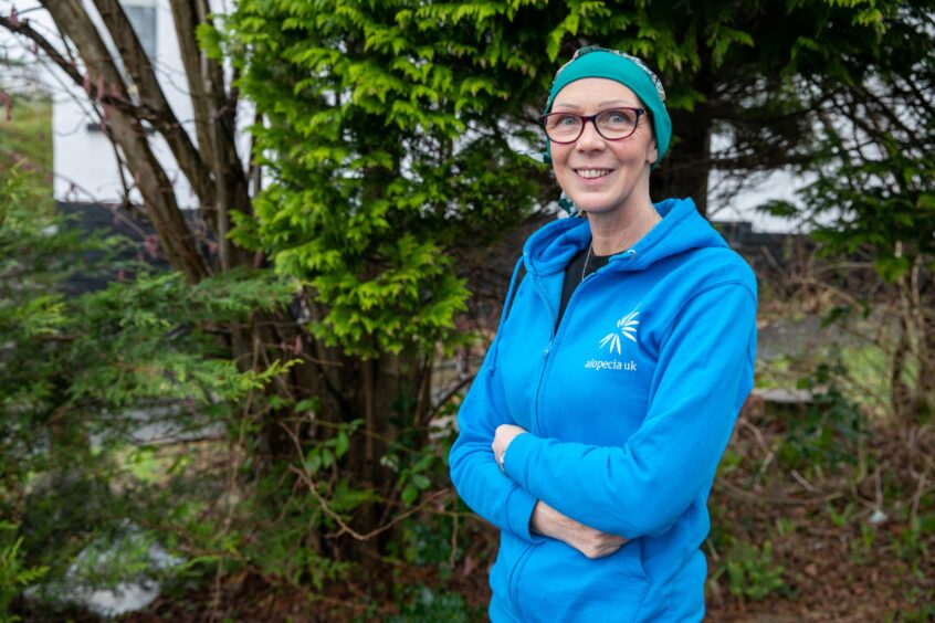 Fife woman Ali Morrison opens up on coming to terms with alopecia.