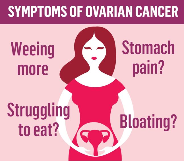 Infographic showing the signs of ovarian cancer.