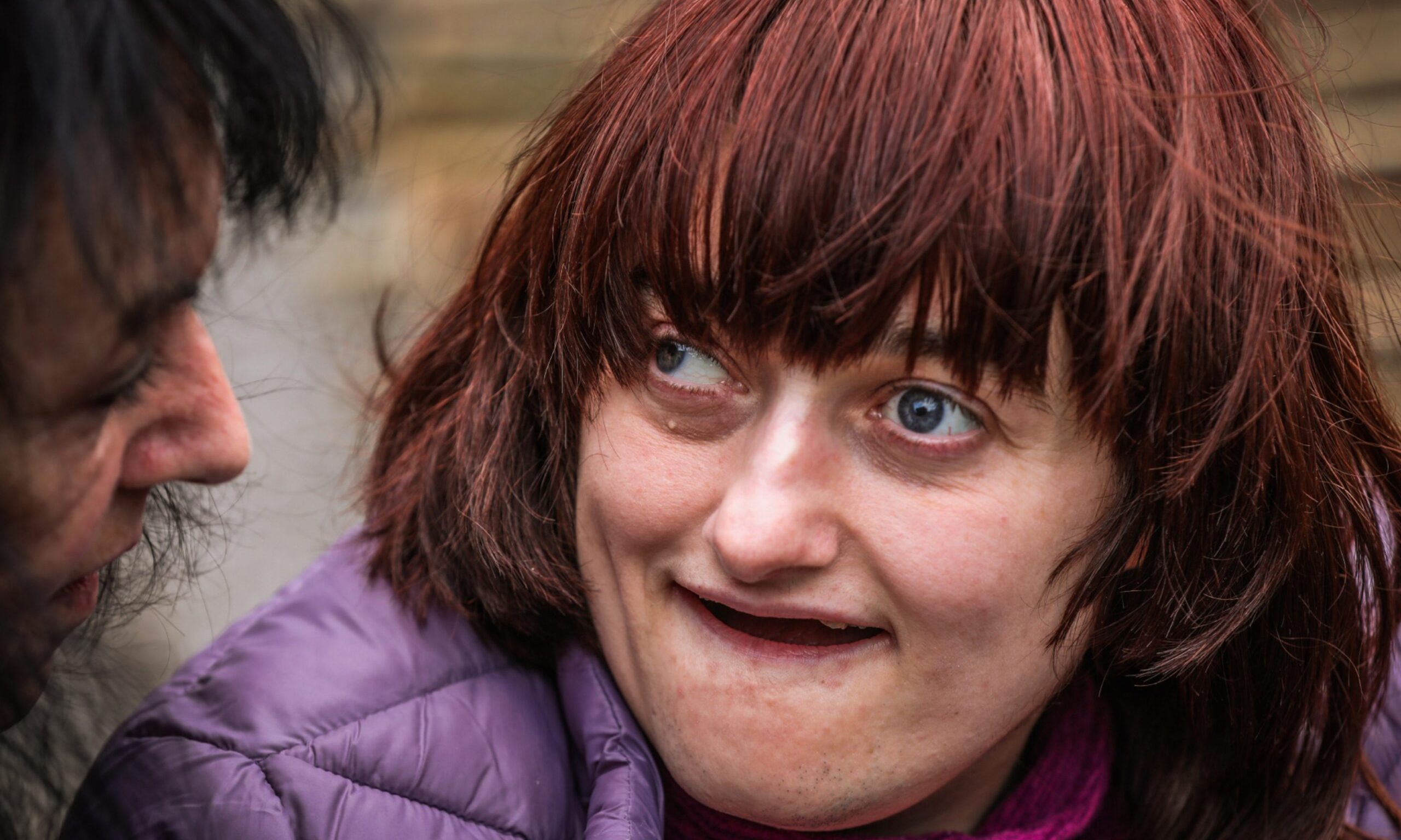 A close up of Becky, who has Angelman syndrome