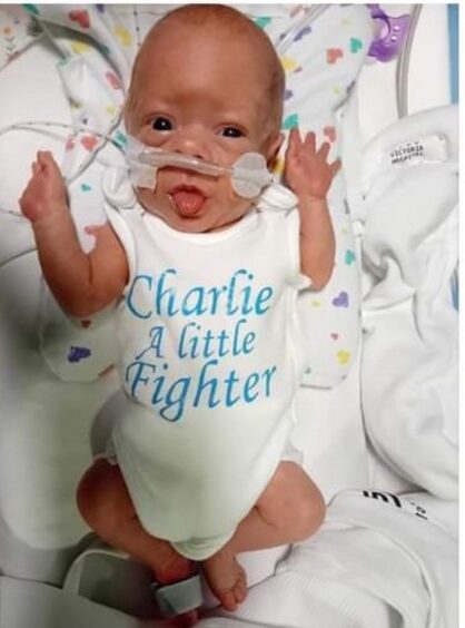  Fife miracle baby Charlie has proved he is a little fighter after doctors didn't expect him to survive.