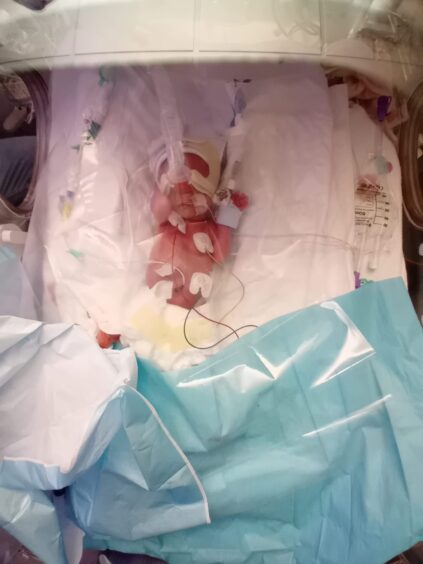 Baby Charlie Auchterlonie only weighed one pound when he was born so had to go into the Wishaw intensive care unit.