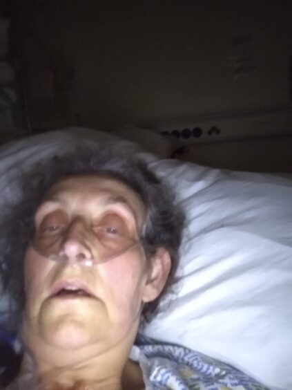 Dee Thomas lying in hospital bed with oxygen mask
