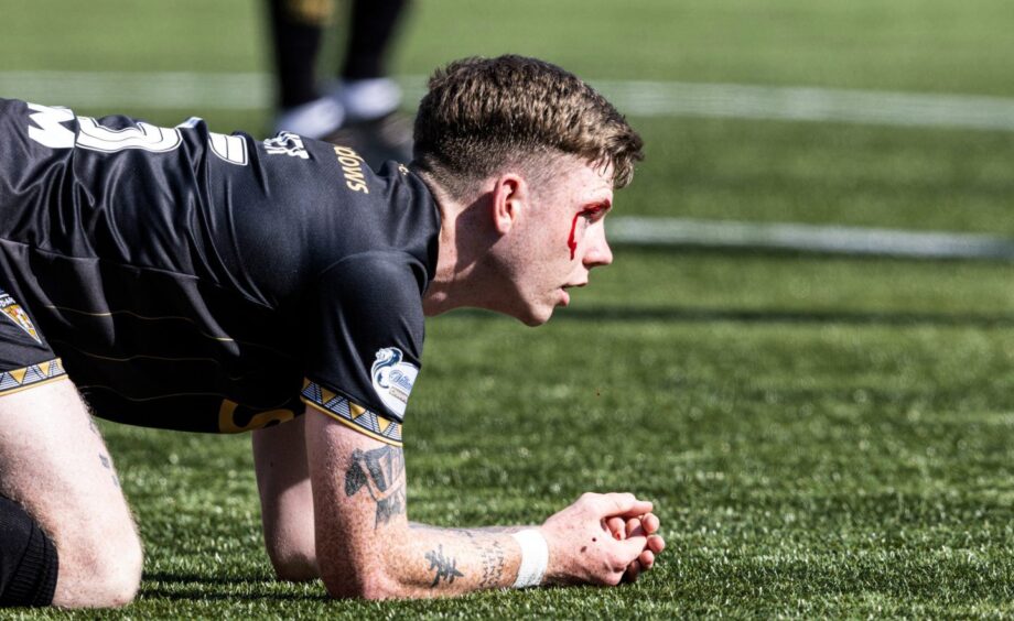 Sam Fisher suffered a cut around his eye during Dunfermline's loss at Livingston.