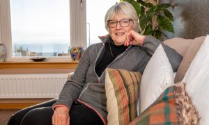 Agnes-Ann Froude from Kinghorn had a thrombectomy which aided her recovery after she had a stroke