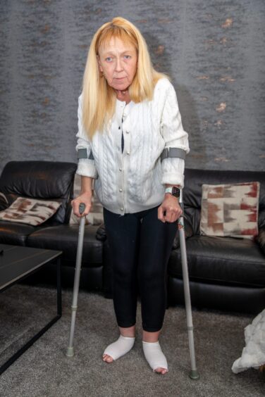 Fife gran Wendy now has to use crutches while waiting for surgery.