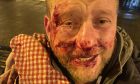 Eddie Smith was attacked on East High Street. Forfar. Image: Supplied