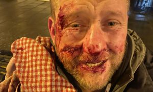 Eddie Smith was attacked on East High Street. Forfar. Image: Supplied