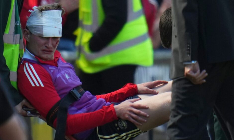 Jack Mackenzie is taken down the tunnel after treatment.
