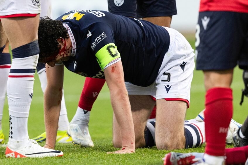 Joe Shaughnessy went off in the second half after a clash of heads. Image: Ross Parker/SNS