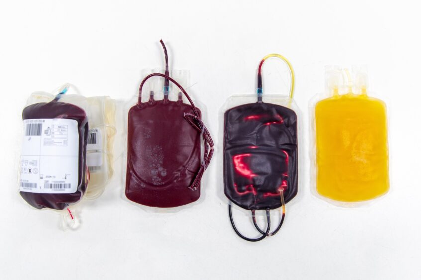 One whole-blood donation alongside bags of red blood cells, buffy coat and plasma.