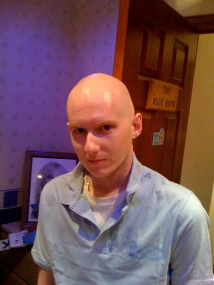 William pictured in June 2009 during treatment.