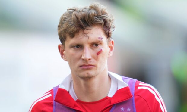 The severity of the damage to Jack Mackenzie was evident.