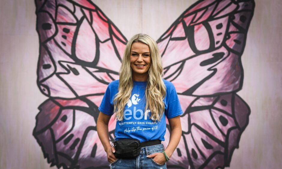 Montrose DEBRA charity campaigner Laura Forsyth.