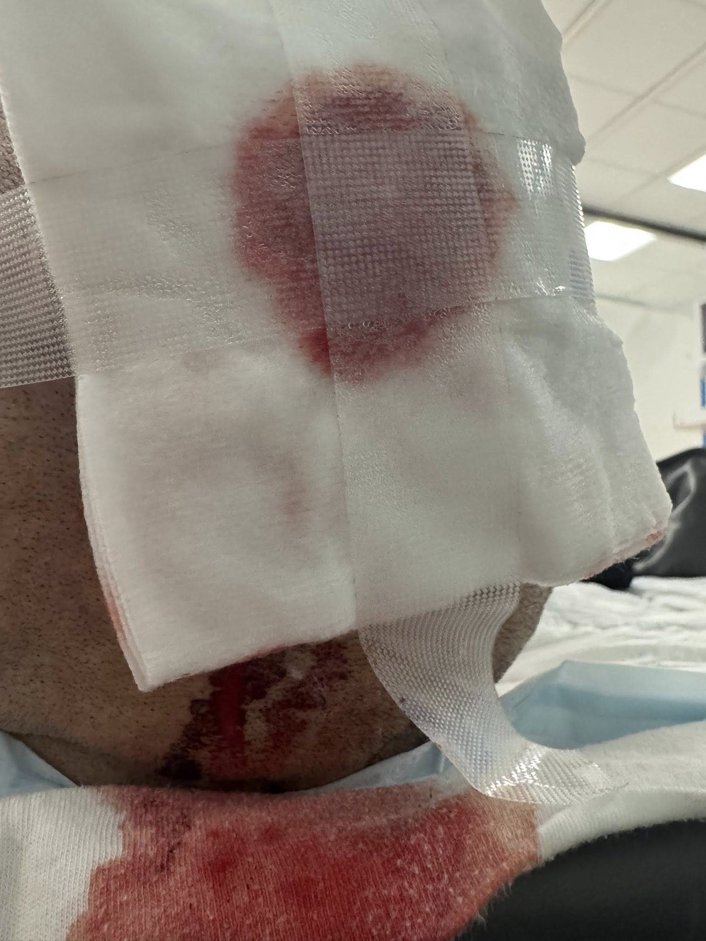 Darren's head injury.