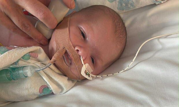 Vinnie Beau receives treatment at the Royal Hospital for Children in Glasgow.