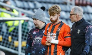 Luca Stephenson injury update after Dundee United ‘broken nose’ fear