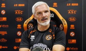 Jim Goodwin reveals surgery plan as Dundee United boss shoots down health scare ‘rumours’