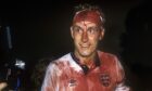 Terry Butcher looked like an extra from a Hammer 
horror film following his head injury in Sweden in 1989.