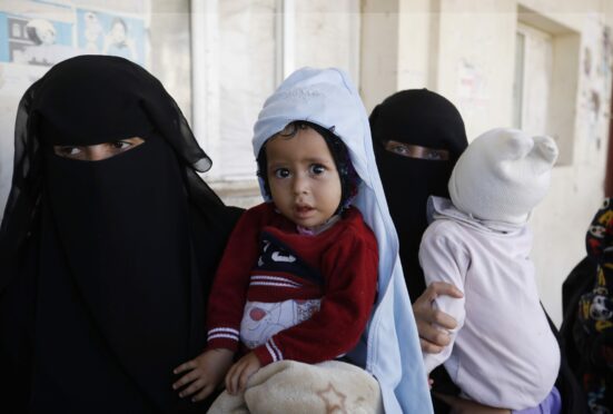 Women, holding their children suffering malnutrition, wait to get monthly shares of food aid in Sana’a in war-torn Yemen