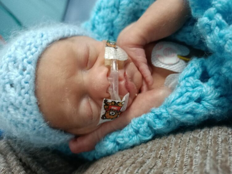 Oliver was born at 27 weeks, weighing just 685 grams.