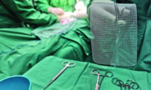 Mesh surgery.