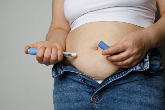 The use of weight-loss drugs is increasing but they are not a magic bullet for obesity, warns expert.