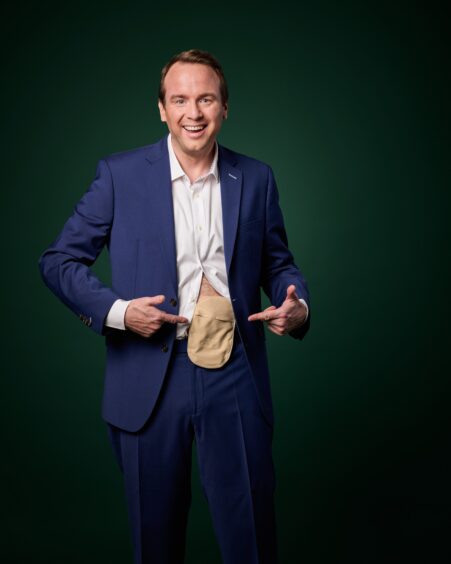 Matt says he’s no longer squeamish about wearing a colostomy bag after his cancer surgery.