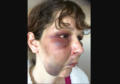 Charlene Whyte suffered horrific injuries in the attack by Thomas Chesterton and Charley Ironside