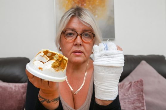 Arleen Mcdonald with her bandaged hand and the tub of curry sauce. Picture by Kenny Elrick