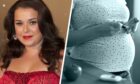 Dani Harmer next to image of a pregnant women with diabetes