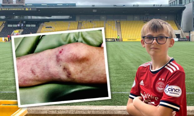 Nine-year-old Riddick Fenton was injured in the stand during Aberdeen FC's match on Saturday. Photo: Shane Fenton.